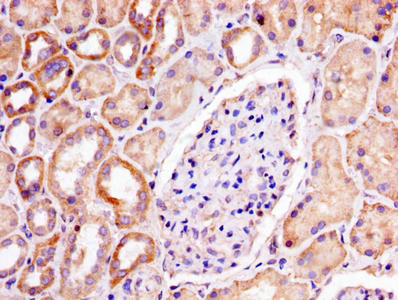IHC image of the antibody diluted at 1:300 and staining in paraffin-embedded human kidney tissue performed on a Leica BondTM system. After dewaxing and hydration, antigen retrieval was mediated by high pressure in a citrate buffer (pH 6.0). Section was blocked with 10% normal goat serum 30min at RT. Then primary antibody (1% BSA) was incubated at 4°C overnight. The primary is detected by a biotinylated secondary antibody and visualized using an HRP conjugated SP system.Rabbit anti-Human PHB Polyclonal Antibody