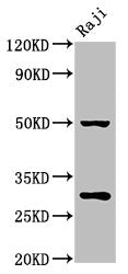 Western Blot  | Positive WB detected in: Raji whole cell lysate  | All lanes: PHB antibody at 4.5µg/ml  | Secondary  | Goat polyclonal to rabbit IgG at 1/50000 dilution  | Predicted band size: 30, 18 kDa  | Observed band size: 30 kDaRabbit anti-Human PHB Polyclonal Antibody