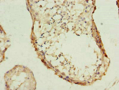 Immunohistochemistry of paraffin-embedded human testis tissue using PHF10 Antibody at dilution of 1:100Rabbit anti-Human PHF10 Polyclonal Antibody