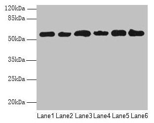 Western blot  | All lanes: PHF10 antibody at 8µg/ml  | Lane 1: Hela whole cell lysate  | Lane 2: 293T whole cell lysate  | Lane 3: A2780 whole cell lysate  | Lane 4: U251 whole cell lysate  | Lane 5: A549 whole cell lysate  | Lane 6: A375 whole cell lysate  | Secondary  | Goat polyclonal to rabbit IgG at 1/10000 dilution  | Predicted band size: 57, 56, 52 kDa  | Observed band size: 57 kDaRabbit anti-Human PHF10 Polyclonal Antibody