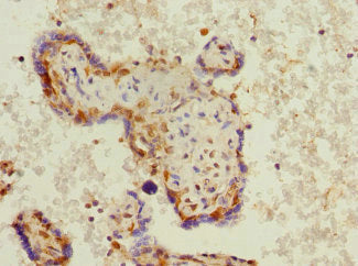 Immunohistochemistry of paraffin-embedded human placenta tissue using PHF11 Antibody at dilution of 1:100Rabbit anti-Human PHF11 Polyclonal Antibody