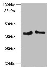 Western blot  | All lanes: PHF11 antibody at 4.36µg/ml  | Lane 1: Jurkat whole cell lysate  | Lane 2: Hela whole cell lysate  | Secondary  | Goat polyclonal to rabbit IgG at 1/10000 dilution  | Predicted band size: 38, 34 kDa  | Observed band size: 38 kDaRabbit anti-Human PHF11 Polyclonal Antibody