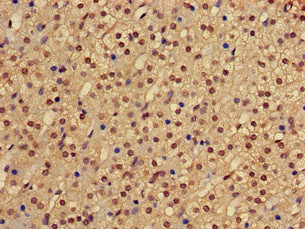 Immunohistochemistry of paraffin-embedded human adrenal gland tissue using PHF21A Antibody at dilution of 1:100Rabbit anti-Human PHF21A Polyclonal Antibody