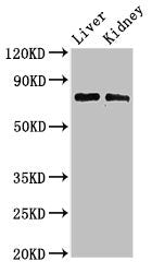 Western Blot | Positive WB detected in: Mouse liver tissue, Mouse kidney tissue | All lanes: PHF21A antibody at 3μg/ml | Secondary | Goat polyclonal to rabbit IgG at 1/50000 dilution | Predicted band size: 75, 71 kDa | Observed band size: 75 kDaRabbit anti-Human PHF21A Polyclonal Antibody