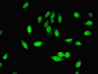 Immunofluorescent analysis of Hela cells using PHF5A Antibody at dilution of 1:100 and Alexa Fluor 488-congugated AffiniPure Goat Anti-Rabbit IgG(H+L)Rabbit anti-Human PHF5A Polyclonal Antibody