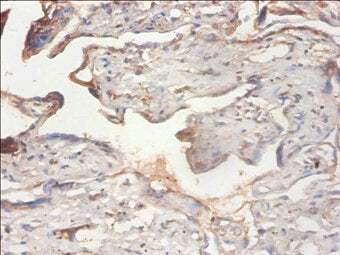 Immunohistochemistry of paraffin-embedded human placenta tissue using the antibody at dilution of 1:100Rabbit anti-Human PHF5A Polyclonal Antibody