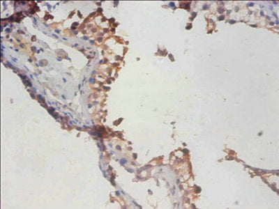 Immunohistochemistry of paraffin-embedded human testis tissue using PHF5A Antibody at dilution of 1:100Rabbit anti-Human PHF5A Polyclonal Antibody