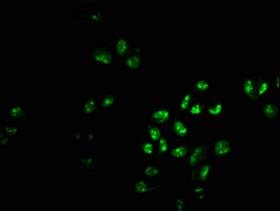Immunofluorescence staining of Hela cells with the antibody at 1:233, counter-stained with DAPI. The cells were fixed in 4% formaldehyde, permeabilized using 0.2% Triton X-100 and blocked in 10% normal Goat Serum. The cells were then incubated with the antibody overnight at 4°C. The secondary antibody was Alexa Fluor 488-congugated AffiniPure Goat Anti-Rabbit IgG(H+L).Rabbit anti-Human PHF6 Polyclonal Antibody