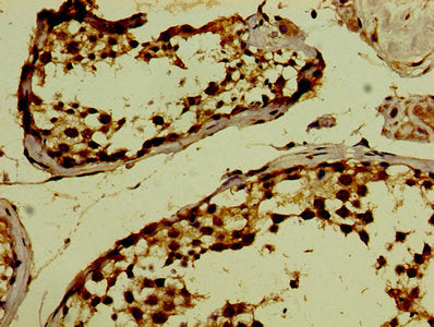 Immunohistochemistry of paraffin-embedded human testis tissue using PHF6 Antibody at dilution of 1:100Rabbit anti-Human PHF6 Polyclonal Antibody