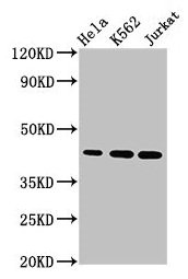 Western Blot  | Positive WB detected in: Hela whole cell lysate, K562 whole cell lysate, Jurkat whole cell lysate  | All lanes: PHF6 antibody at 2.8µg/ml  | Secondary  | Goat polyclonal to rabbit IgG at 1/50000 dilution  | Predicted band size: 42, 36, 38 kDa  | Observed band size: 42 kDaRabbit anti-Human PHF6 Polyclonal Antibody