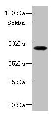 Western blot  | All lanes: PHKG2 antibody at 3.4µg/ml + HepG2 whole cell lysate  | Secondary  | Goat polyclonal to rabbit IgG at 1/10000 dilution  | Predicted band size: 47, 44 kDa  | Observed band size: 47 kDaRabbit anti-Human PHKG2 Polyclonal Antibody