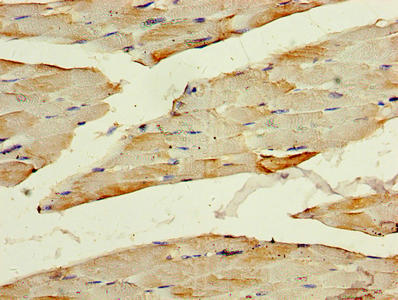 Immunohistochemistry of paraffin-embedded human skeletal muscle tissue using PHPT1 Antibody at dilution of 1:100Rabbit anti-Human PHPT1 Polyclonal Antibody