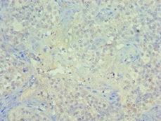Immunohistochemistry of paraffin-embedded human tonsil tissue using the antibody at dilution of 1:100Rabbit anti-Human PIAS1 Polyclonal Antibody