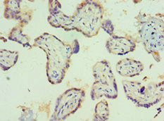 Immunohistochemistry of paraffin-embedded human placenta tissue using PIAS1 Antibody at dilution of 1:100Rabbit anti-Human PIAS1 Polyclonal Antibody