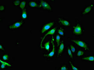 Immunofluorescent analysis of Hela cells using PIGA Antibody at dilution of 1:100 and Alexa Fluor 488-congugated AffiniPure Goat Anti-Rabbit IgG(H+L)Rabbit anti-Human PIGA Polyclonal Antibody