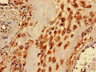 Immunohistochemistry of paraffin-embedded human placenta tissue using the antibody at dilution of 1:100Rabbit anti-Human PIGA Polyclonal Antibody