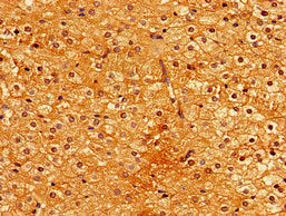 Immunohistochemistry of paraffin-embedded human adrenal gland tissue using PIGA Antibody at dilution of 1:100Rabbit anti-Human PIGA Polyclonal Antibody