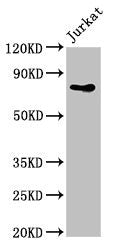 Western Blot | Positive WB detected in: Jurkat whole cell lysate | All lanes: PIK3R2 antibody at 4μg/ml | Secondary | Goat polyclonal to rabbit IgG at 1/50000 dilution | Predicted band size: 82 kDa | Observed band size: 82 kDaRabbit anti-Human PIK3R2 Polyclonal Antibody
