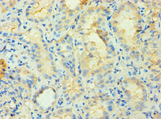 Immunohistochemistry of paraffin-embedded human kidney tissue using PIP4K2B Antibody at dilution of 1:100Rabbit anti-Human PIP4K2B Polyclonal Antibody