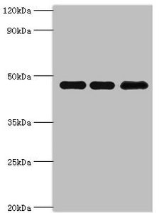 Western blot | All lanes: Phosphatidylinositol 5-phosphate 4-kinase type-2 beta antibody at 10μg/ml | Lane 1: Hela whole cell lysate | Lane 2: MCF-7 whole cell lysate | Lane 3: 293T whole cell lysate | Secondary | Goat polyclonal to rabbit IgG at 1/10000 dilution | Predicted band size: 48, 33 kDa | Observed band size: 48 kDaRabbit anti-Human PIP4K2B Polyclonal Antibody