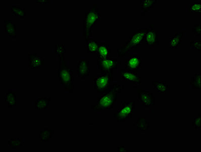 Immunofluorescence staining of U251 cells with PIR Antibody at 1:100, counter-stained with DAPI. The cells were fixed in 4% formaldehyde, permeabilized using 0.2% Triton X-100 and blocked in 10% normal Goat Serum. The cells were then incubated with the antibody overnight at 4°C. The secondary antibody was Alexa Fluor 488-congugated AffiniPure Goat Anti-Rabbit IgG(H+L).Rabbit anti-Human PIR Polyclonal Antibody