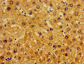 Immunohistochemistry of paraffin-embedded human liver tissue using the antibody at dilution of 1:100Rabbit anti-Human PIR Polyclonal Antibody