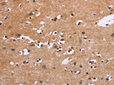 The image on the left is immunohistochemistry of paraffin-embedded Human brain tissue using EGR4 Antibody(EGR4 Antibody) at dilution 1/20, on the right is treated with synthetic peptide. (Original magnification: ×200)Rabbit anti-Human EGR4 Polyclonal Antibody