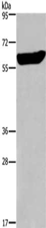 Gel: 6%SDS-PAGE,Lysate: 40 μg,,Primary antibody: EGR4 Antibody(EGR4 Antibody) at dilution 1/300 dilution,Secondary antibody: Goat anti rabbit IgG at 1/8000 dilution,Exposure time: 30 secondsRabbit anti-Human EGR4 Polyclonal Antibody