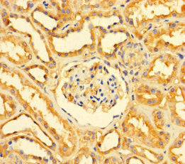 Immunohistochemistry of paraffin-embedded human kidney tissue using GATD3A Antibody at dilution of 1:100Rabbit anti-Human GATD3A Polyclonal Antibody