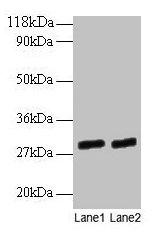 Western blot  | All lanes: GATD3A antibody at 2µg/ml  | Lane 1: EC109 whole cell lysate  | Lane 2: 293T whole cell lysate  | Secondary  | Goat polyclonal to rabbit IgG at 1/15000 dilution  | Predicted band size: 29, 25 kDa  | Observed band size: 29 kDaRabbit anti-Human GATD3A Polyclonal Antibody