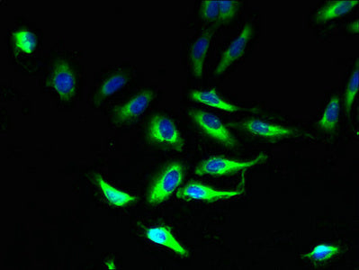 Immunofluorescent analysis of Hela cells using PLP1 Antibody at dilution of 1:100 and Alexa Fluor 488-congugated AffiniPure Goat Anti-Rabbit IgG(H+L)Rabbit anti-Human PLP1 Polyclonal Antibody