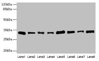 Western blot  | All lanes: PLP1 antibody at 4µg/ml  | Lane 1: Hela whole cell lysate  | Lane 2: HL60 whole cell lysate  | Lane 3: K562 whole cell lysate  | Lane 4: THP-1 whole cell lysate  | Lane 5: U937 whole cell lysate  | Lane 6: A549 whole cell lysate  | Lane 7: Caco-2 whole cell lysate  | Lane 8: HepG2 whole cell lysate  | Secondary  | Goat polyclonal to rabbit IgG at 1/10000 dilution  | Predicted band size: 31, 27 kDa  | Observed band size: 31 kDaRabbit anti-Human PLP1 Polyclonal Antibody