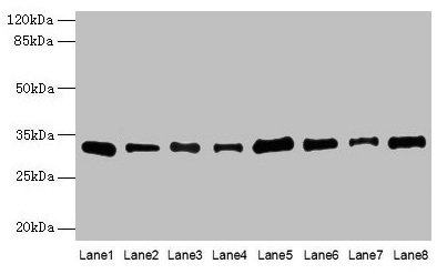 Western blot  | All lanes: PLP1 antibody at 4µg/ml  | Lane 1: Hela whole cell lysate  | Lane 2: HL60 whole cell lysate  | Lane 3: K562 whole cell lysate  | Lane 4: THP-1 whole cell lysate  | Lane 5: U937 whole cell lysate  | Lane 6: A549 whole cell lysate  | Lane 7: Caco-2 whole cell lysate  | Lane 8: HepG2 whole cell lysate  | Secondary  | Goat polyclonal to rabbit IgG at 1/10000 dilution  | Predicted band size: 31, 27 kDa  | Observed band size: 31 kDaRabbit anti-Human PLP1 Polyclonal Antibody