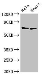 Western Blot  | Positive WB detected in: Hela whole cell lysate, Mouse heart tissue  | All lanes: PLS3 antibody at 3.4µg/ml  | Secondary  | Goat polyclonal to rabbit IgG at 1/50000 dilution  | Predicted band size: 71, 70, 66 kDa  | Observed band size: 71 kDaRabbit anti-Human PLS3 Polyclonal Antibody