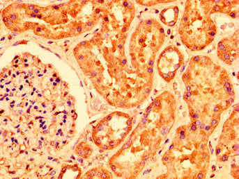 IHC image of PLXNB1 Antibody diluted at 1:200 and staining in paraffin-embedded human kidney tissue performed on a Leica BondTM system. After dewaxing and hydration, antigen retrieval was mediated by high pressure in a citrate buffer (pH 6.0). Section was blocked with 10% normal goat serum 30min at RT. Then primary antibody (1% BSA) was incubated at 4°C overnight. The primary is detected by a biotinylated secondary antibody and visualized using an HRP conjugated SP system.Rabbit anti-Human PLXNB1 Polyclonal Antibody