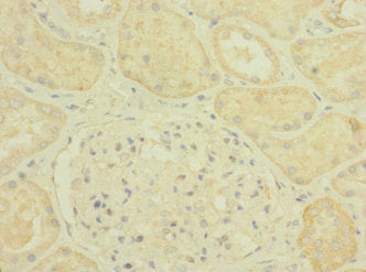 Immunohistochemistry of paraffin-embedded human kidney tissue using PLXNB2 Antibody at dilution of 1:100Rabbit anti-Human PLXNB2 Polyclonal Antibody