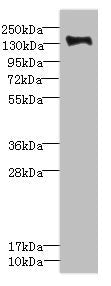 Western blot | All lanes: PLXNB2 antibody IgG at 2.39μg/ml + Mouse liver tissue | Secondary | Goat polyclonal to rabbit IgG at 1/10000 dilution | Predicted band size: 205 kDa | Observed band size: 205 kDaRabbit anti-Human PLXNB2 Polyclonal Antibody