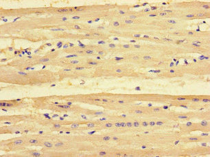 Immunohistochemistry of paraffin-embedded human heart tissue using the antibody at dilution of 1:100Rabbit anti-Human PMAIP1 Polyclonal Antibody