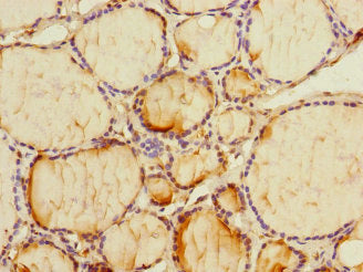 Immunohistochemistry of paraffin-embedded human thyroid tissue using PMM2 Antibody at dilution of 1:100Rabbit anti-Human PMM2 Polyclonal Antibody
