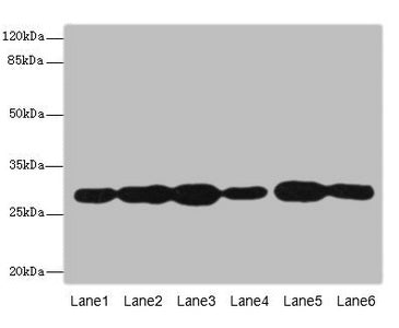 Western blot  | All lanes: PMM2 antibody at 3.8µg/ml  | Lane 1: A549 whole cell lysate  | Lane 2: HepG2 whole cell lysate  | Lane 3: MCF-7 whole cell lysate  | Lane 4: K562 whole cell lysate  | Lane 5: Hela whole cell lysate  | Lane 6: 293T whole cell lysate  | Secondary  | Goat polyclonal to rabbit IgG at 1/10000 dilution  | Predicted band size: 29, 14 kDa  | Observed band size: 29 kDaRabbit anti-Human PMM2 Polyclonal Antibody