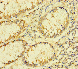 Immunohistochemistry of paraffin-embedded human colon cancer using FAU Antibody at dilution of 1:100Rabbit anti-Human FAU Polyclonal Antibody