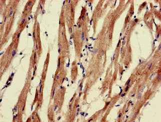 Immunohistochemistry of paraffin-embedded human heart tissue using PNLIPRP3 Antibody at dilution of 1:100Rabbit anti-Human PNLIPRP3 Polyclonal Antibody