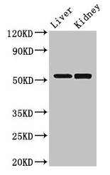 Western Blot  | Positive WB detected in: Mouse liver tissue, Mouse kidney tissue  | All lanes: PNLIPRP3 antibody at 3.5µg/ml  | Secondary  | Goat polyclonal to rabbit IgG at 1/50000 dilution  | Predicted band size: 53 kDa  | Observed band size: 53 kDaRabbit anti-Human PNLIPRP3 Polyclonal Antibody