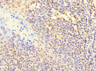 Immunohistochemistry of paraffin-embedded human tonsil tissue using POLB Antibody at dilution of 1:100Rabbit anti-Human POLB Polyclonal Antibody