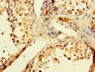 Immunohistochemistry of paraffin-embedded human testis tissue using POLB Antibody at dilution of 1:100Rabbit anti-Human POLB Polyclonal Antibody