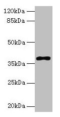 Western blot  | All lanes: POLB antibody at 8µg/ml + Colo320 whole cell lysate  | Secondary  | Goat polyclonal to rabbit IgG at 1/10000 dilution  | Predicted band size: 39 kDa  | Observed band size: 39 kDaRabbit anti-Human POLB Polyclonal Antibody
