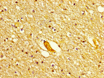 IHC image of POLD1 Antibody diluted at 1:300 and staining in paraffin-embedded human brain tissue performed on a Leica BondTM system. After dewaxing and hydration, antigen retrieval was mediated by high pressure in a citrate buffer (pH 6.0). Section was blocked with 10% normal goat serum 30min at RT. Then primary antibody (1% BSA) was incubated at 4°C overnight. The primary is detected by a biotinylated secondary antibody and visualized using an HRP conjugated SP system.Rabbit anti-Human POLD1 Polyclonal Antibody