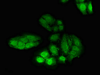 Immunofluorescent analysis of HepG2 cells using POLH Antibody at dilution of 1:100 and Alexa Fluor 488-congugated AffiniPure Goat Anti-Rabbit IgG(H+L)