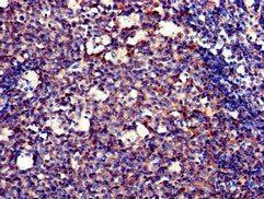 Immunohistochemistry of paraffin-embedded human tonsil tissue using POLH Antibody at dilution of 1:100