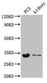 Western Blot  | Positive WB detected in: PC-3 whole cell lysate, Mouse kidney tissue  | All lanes: POLR2C antibody at 3.5µg/ml  | Secondary  | Goat polyclonal to rabbit IgG at 1/50000 dilution  | Predicted band size: 32 kDa  | Observed band size: 32 kDa